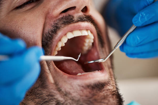Best Emergency Dental Care for Sports Injuries in Greencastle, PA
